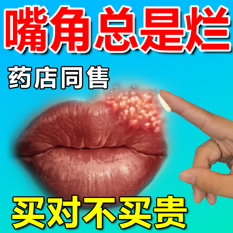 口角炎药膏舌舔唇炎烂嘴角药膏口唇干裂糜烂起泡口周皮炎润唇专用