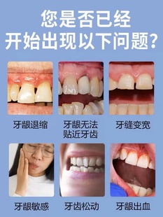 牙齿松动牙膏治牙周炎牙龈肿痛萎缩牙痛咀嚼无力固齿牙齿晃动的药