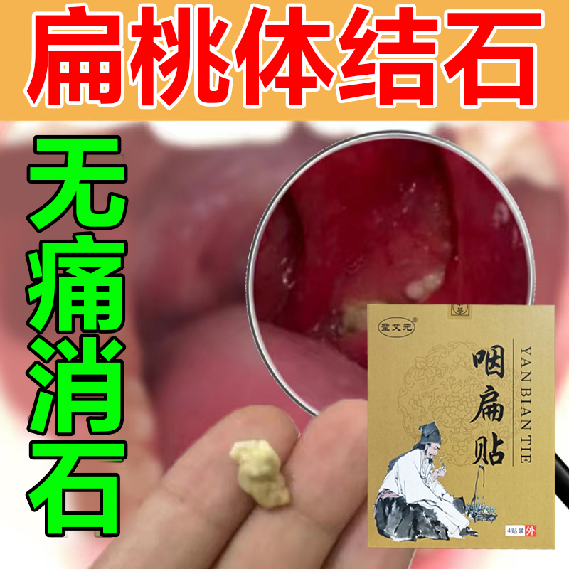 扁桃体结石去除工具