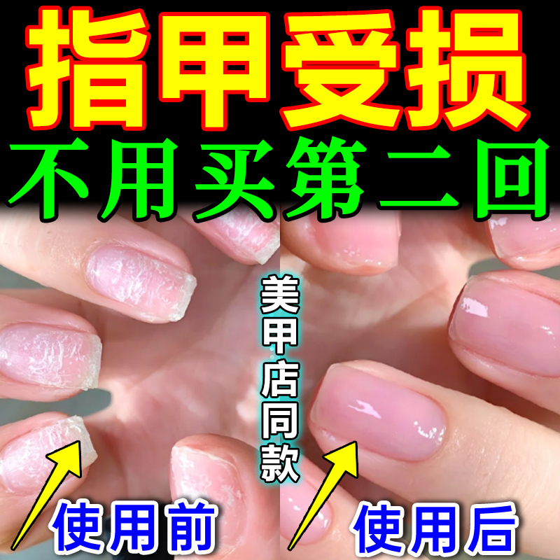 指甲修复液受损再生养甲床增厚薄软防断裂营养液保护理生长边缘油