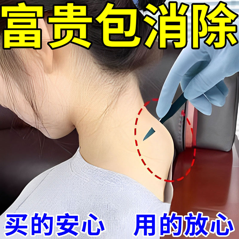 【消除神器】解决各种颈椎问题脖子酸