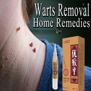 5M Skin Tag Remover Agat Mole & Genital Wart fast