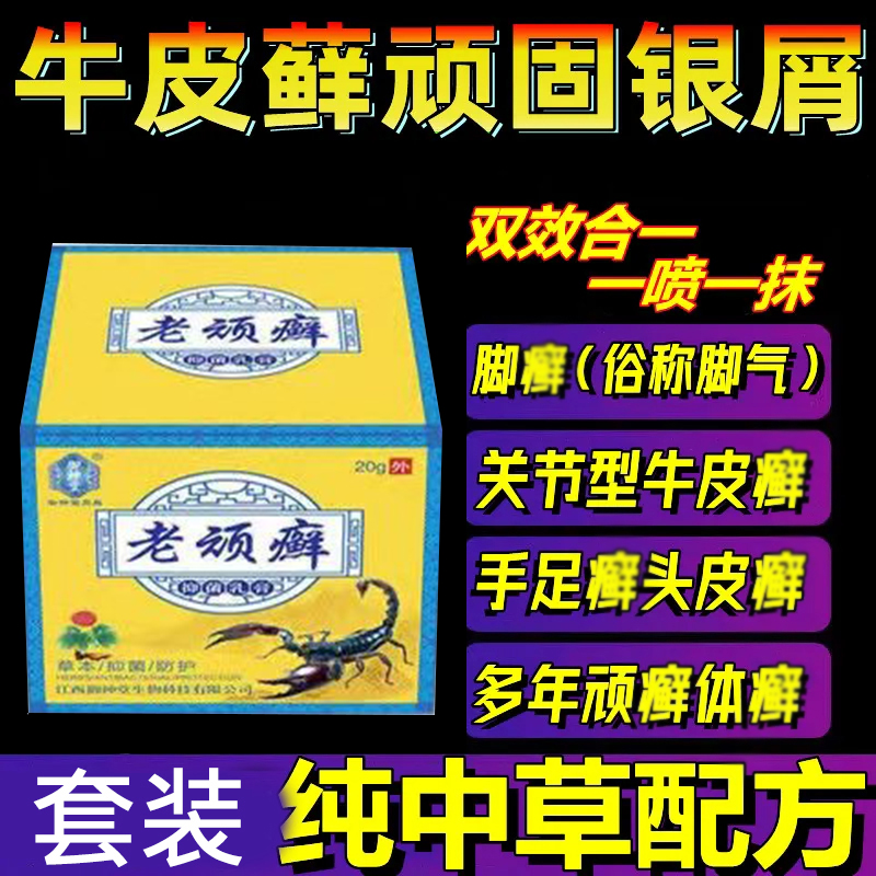 老顽癣顽固性牛皮癣皮肤瘙痒皮炎湿疹止痒药去 根外用抑菌老偏方