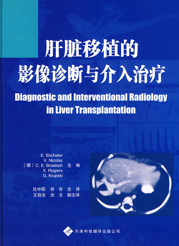 正版现货 移植的影像诊断与介入 (德)布彻勒 等编 沈中阳 等译 天津科技翻译出版公司 3107在类目 书籍/杂志/报纸, 医学卫生, 医学其它中 - 来自Buy2taobao.com提供专业的淘宝代购服务