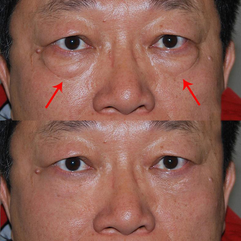 特价男士眼霜去黑眼圈眼袋 屈臣氏