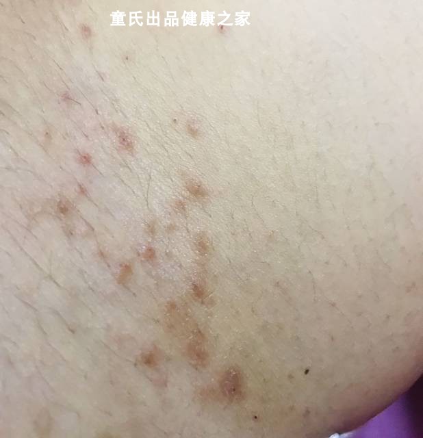 屁眼私密舒外用潮湿肛门外用男性肛周儿童外阴沐浴露