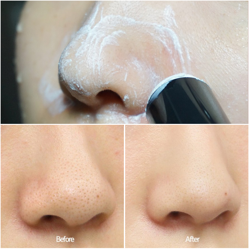 韩国进口磨砂吸黑头棒神器一抹净粉刺去白头收缩毛孔草莓鼻子修复