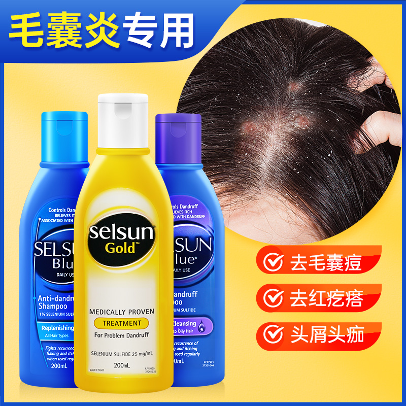 去毛囊炎专用洗发水蓝瓶干燥起皮头皮屑真菌药男士马拉色菌男专用