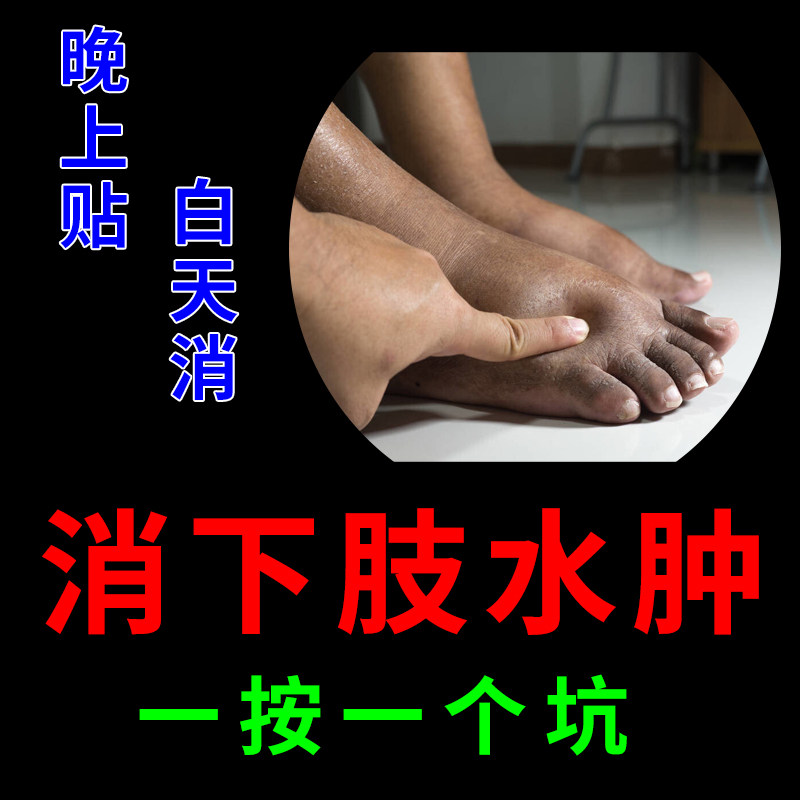 利尿排水肿消^肿药去下肢水肿神器贴脸部浮肿老人小腿脚肿消的药