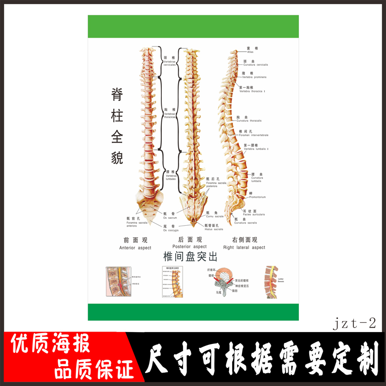 人体骨骼正脊脊椎挂图脊柱相关疾病示意图医院写真