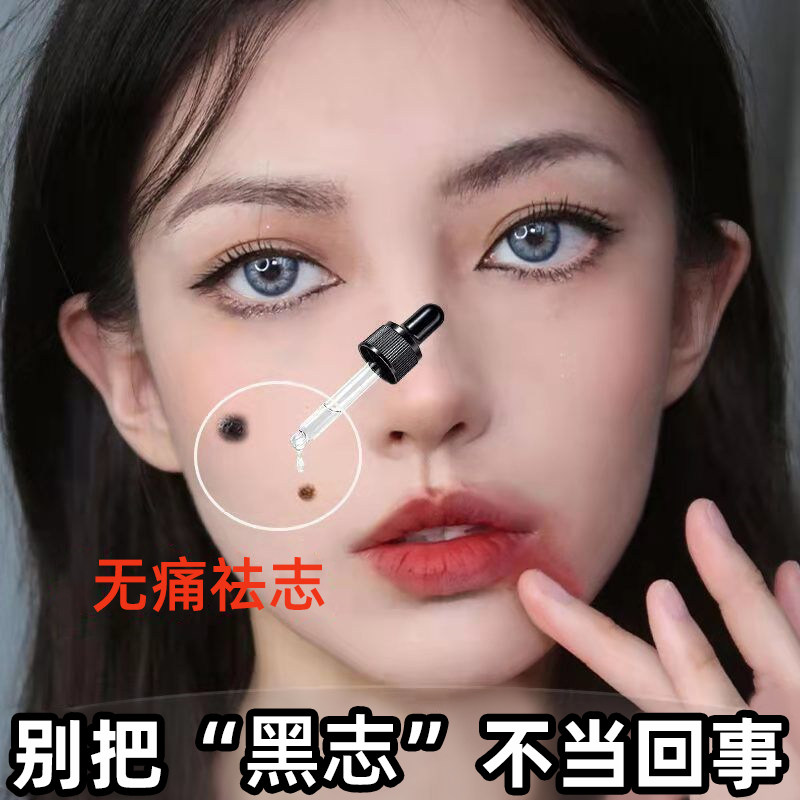 取脸部黑痣去除液无痕正品药水点雀斑水点痦子美容院专用神器祛灵