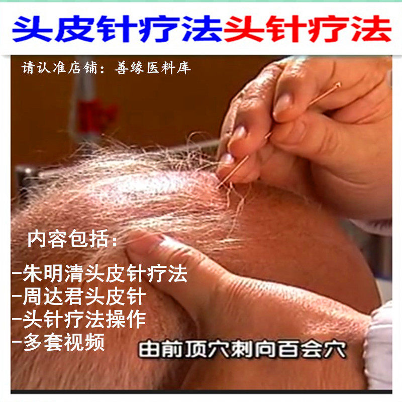 邱飞虎闪电针法治疑杂病美容祛斑针法奇特一针疗法10g高清视频3张