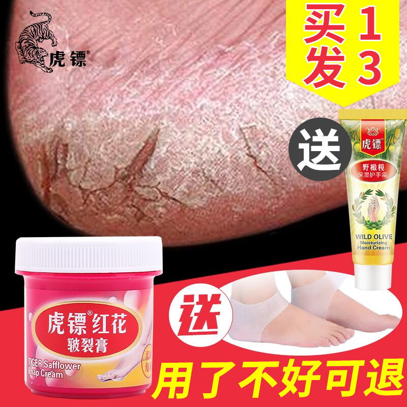 脚后跟干裂龟裂膏防裂皲裂开裂护手足裂口愈合脱皮修复滋润马油霜