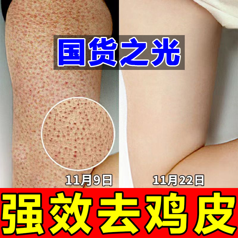 上喉皮肤像鸡皮瘙痒(喉咙那里的皮肤为啥特别痒)