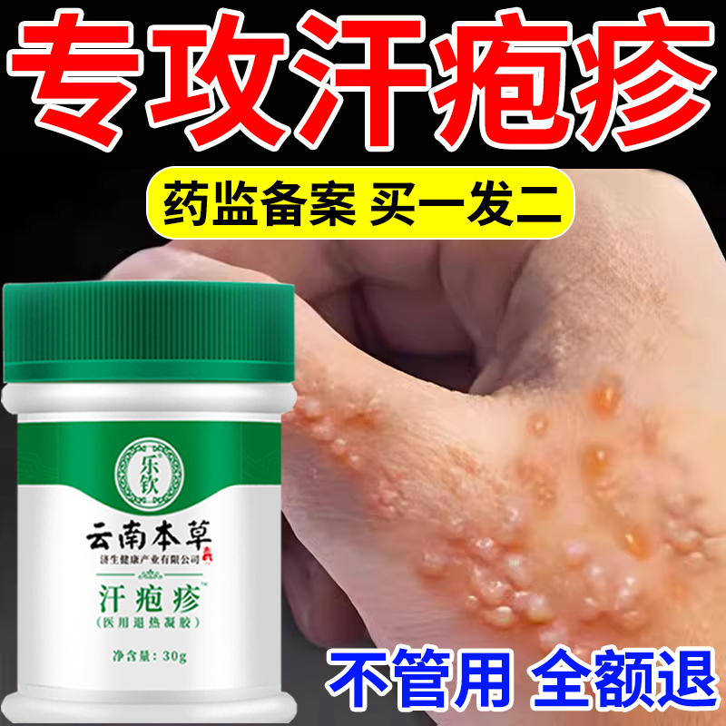 云南本草汗疱疹汗泡疱疹药膏湿疹手上