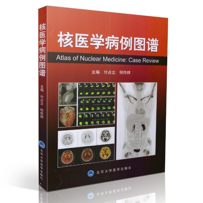 现货 核医学病例图谱 付占立 何作祥主编 北京大学医学出版社|msdalam kategori buku/Magazine/akhbar, Kesihatan perubatan, peta perubatan - dari Buy2taobao.com untuk memberikan perkhidmatan ejen Taobao profesional membeli