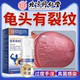 【龟头有裂纹】发炎挫伤专用手淫过度疼痛膏真菌感染特效喷剂X