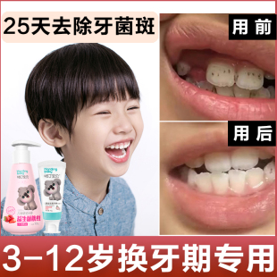儿童牙膏6一12岁换牙期9去牙菌斑黑牙10岁以上3去黄防蛀牙8小学生