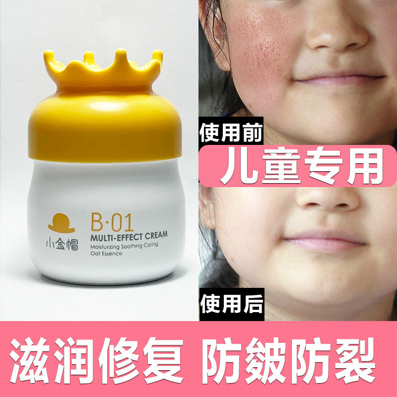 儿童宝宝面霜秋冬季红色小象婴儿防皲裂呵护防冻护肤保湿霜男女孩