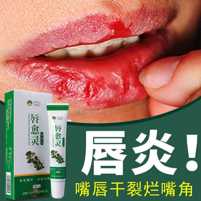 唇膏嘴巴干燥嘴唇干裂起皮疱疹上火起泡唇炎烂嘴角脱皮非专用非药