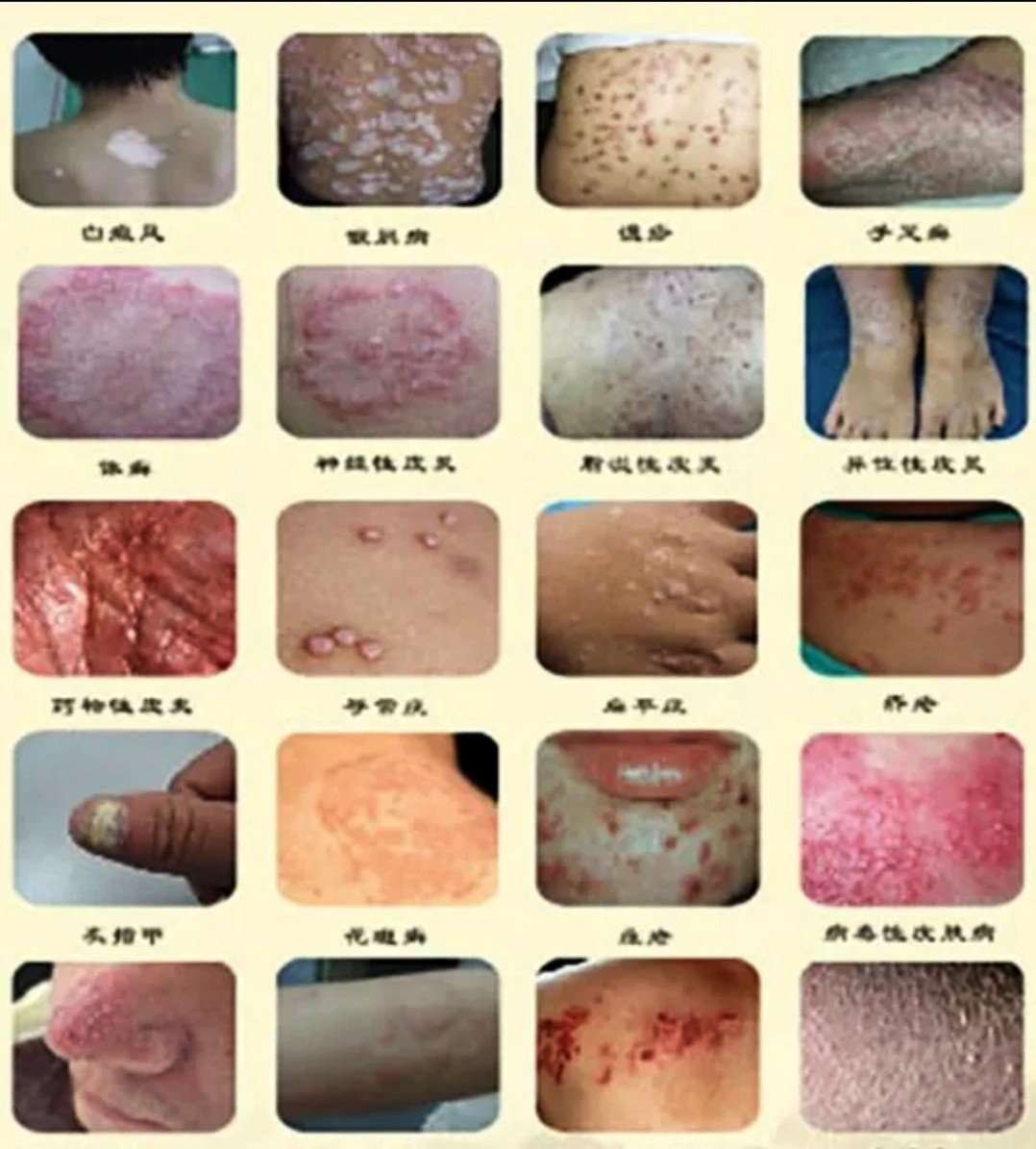 口服手足银癣美肤牛皮银杏胶囊