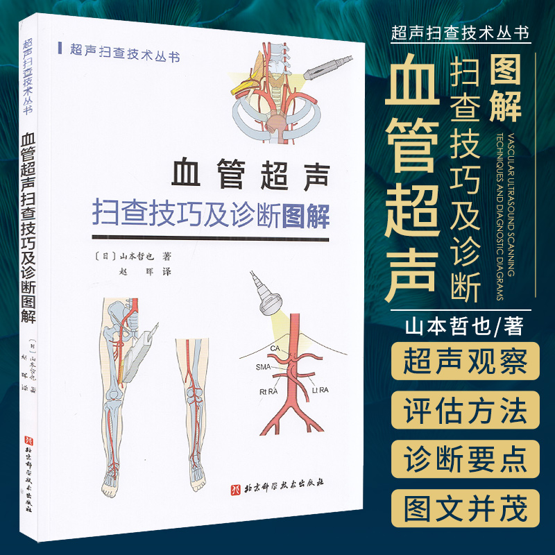 血管超声扫查技巧及诊断图解 山本哲
