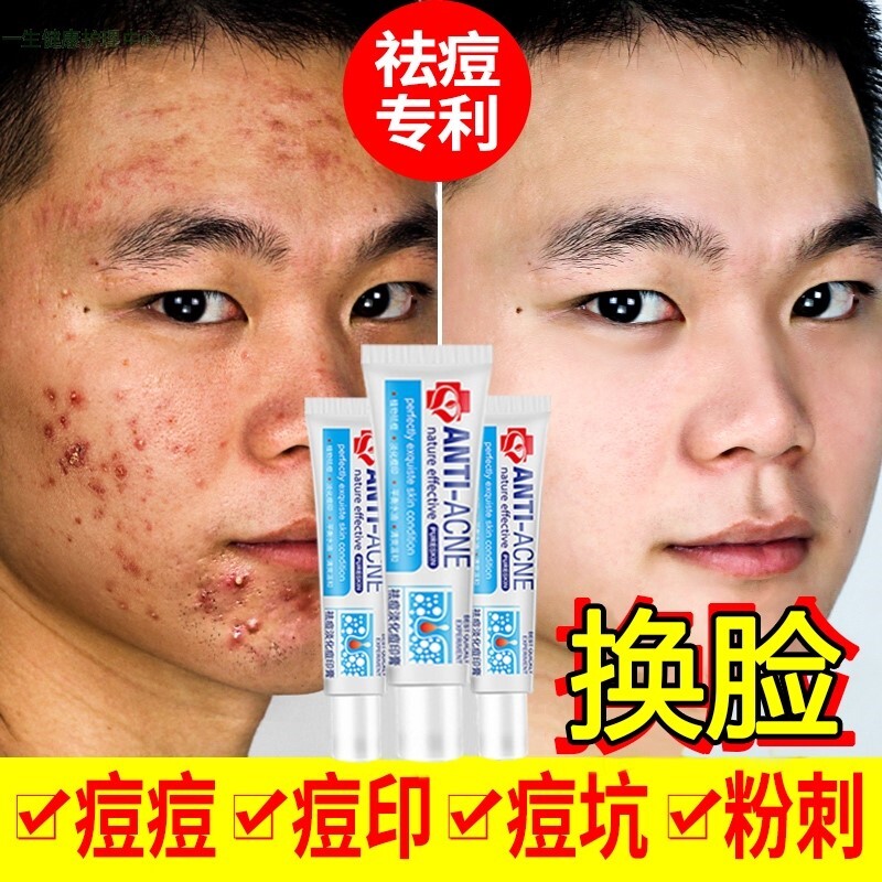 安幼佑颜净肤舒尔耳丹皮傲宁冷凝胶ggacc凝胶uutnn朱玉草本中清肌