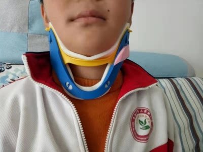 颈托斜颈矫正器小孩婴儿歪脖子矫形纠正偏头测斜视治歪头颈托优惠券