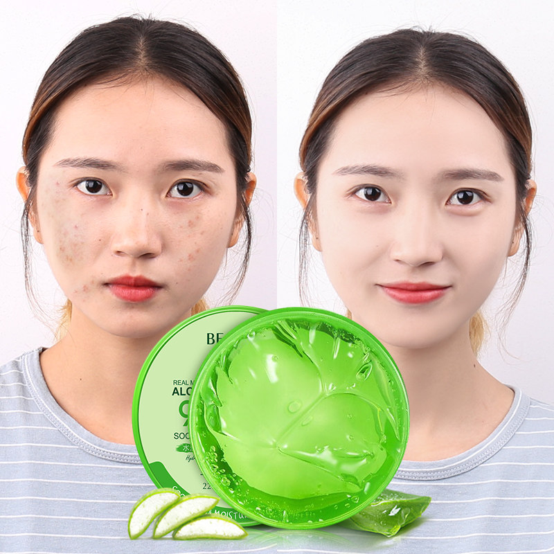 芦荟胶正品祛痘补水保湿面霜疤痕膏痘印学生去产品前女五强送美白