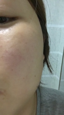 Re:评测下苏秘sum37呼吸惊喜水分套盒怎么样??体验效果sum37呼吸惊喜水分套盒好不好 ..