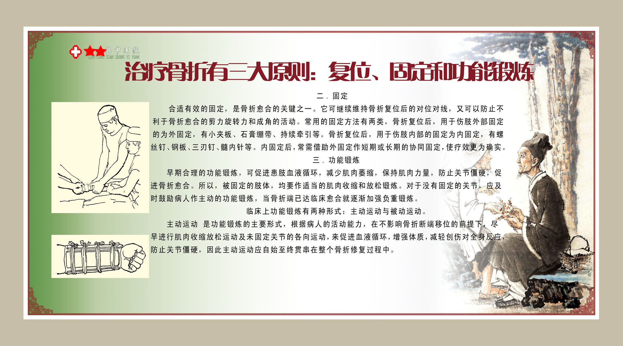 海报印制展板写真喷绘贴纸医院骨科骨折原则写真