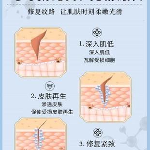 新品妊辰纹消除去妊娠纹产后消除紧致祛除肥胖纹生长纹遮挡淡化修