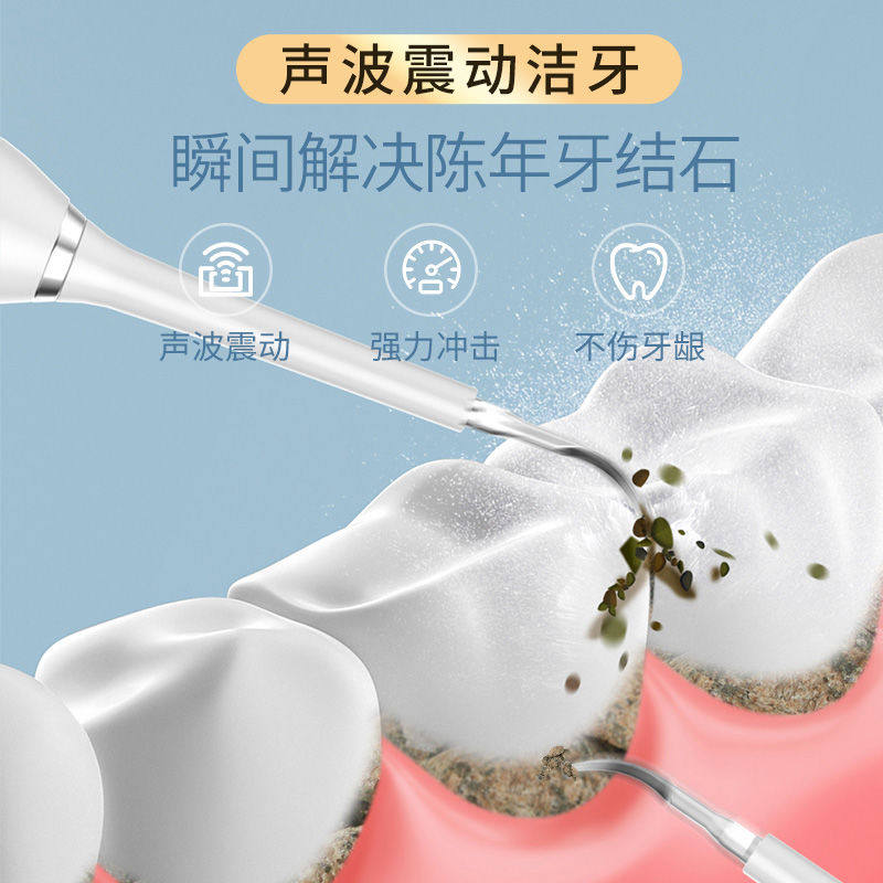 洗牙仪超声波牙结石去除器洁牙器牙渍神器