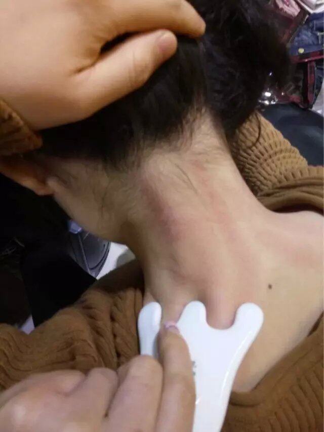 全身通用陶瓷刮痧板女颈部脸部面部套装刮痧祛湿淋巴排du刮痧仪器