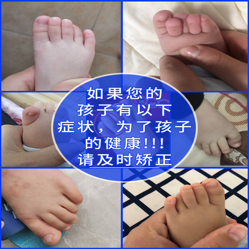 儿童脚趾头矫正器大母脚趾头变形弯曲重叠宝宝婴儿幼儿小孩分趾器