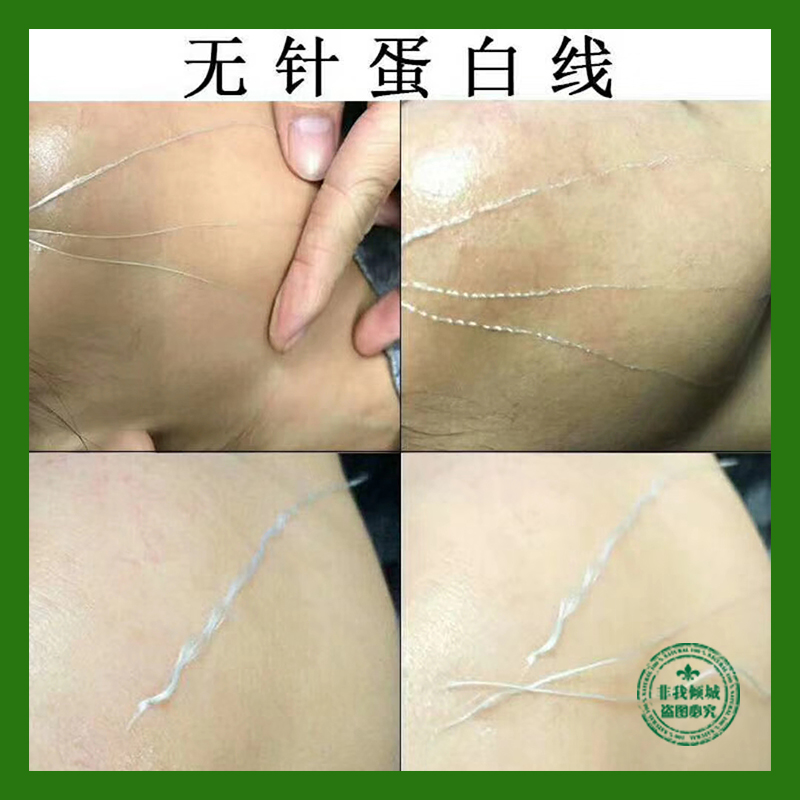 无针线雕蚕丝蛋白线多肽寡肽线雕丝紧致提升v脸线雕仪美容院专用