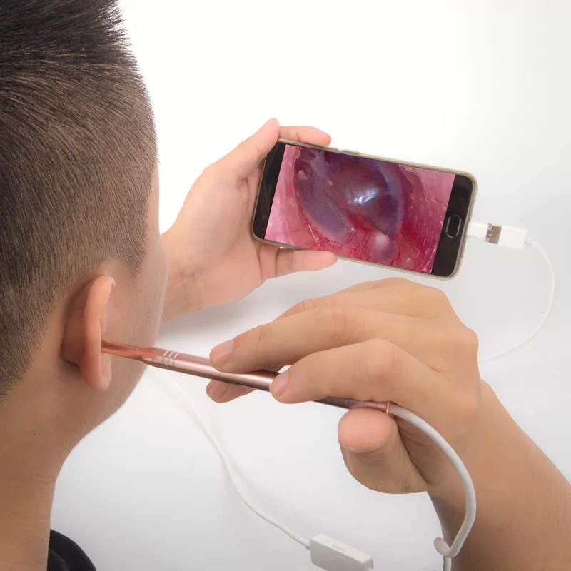 耳科赵医生可视挖耳勺高清手机外耳道内窥镜采耳神器可视掏耳朵勺