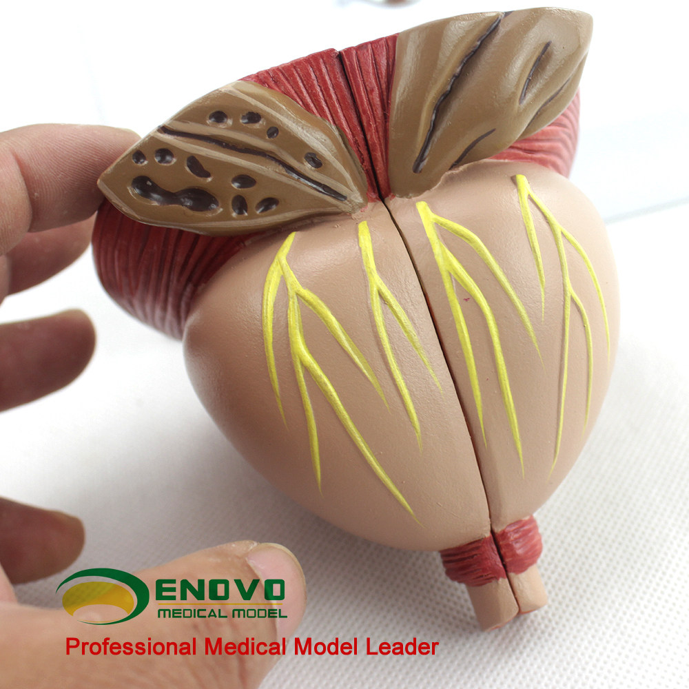前列腺模型男科enovo颐诺医学解剖前列腺炎生殖健康区分教学仪器