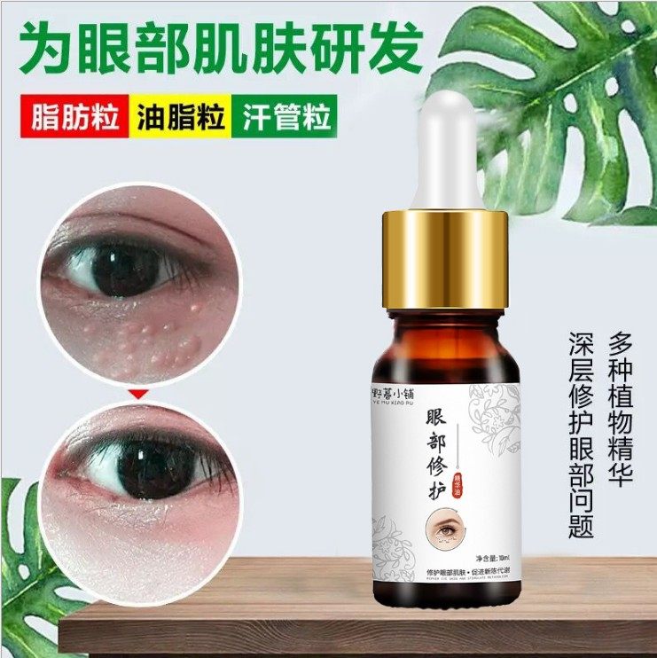 脂肪眼霜粒汗管瘤油脂专用消除眼部颗粒精华眼霜
