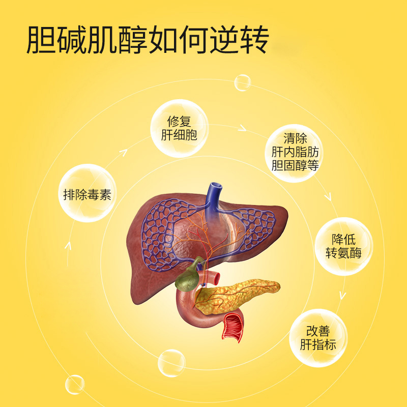 oppuland进口胆碱肌醇成人降脂降转氨酶清肝护肝保健