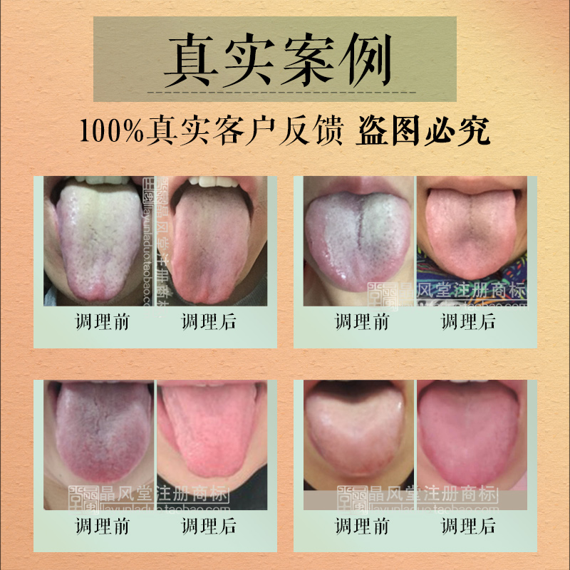 舌苔厚白黄腻肠胃不好调理口腔清爽爽口气口养生茶
