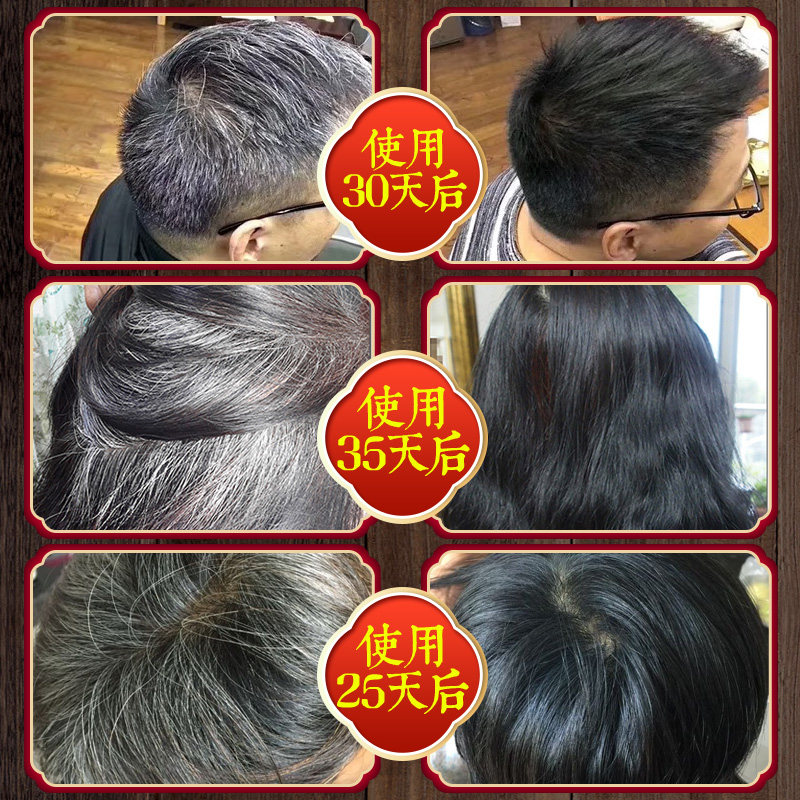 何首乌白发变转黑发草本洗发水治纯植物食疗克星洗发水