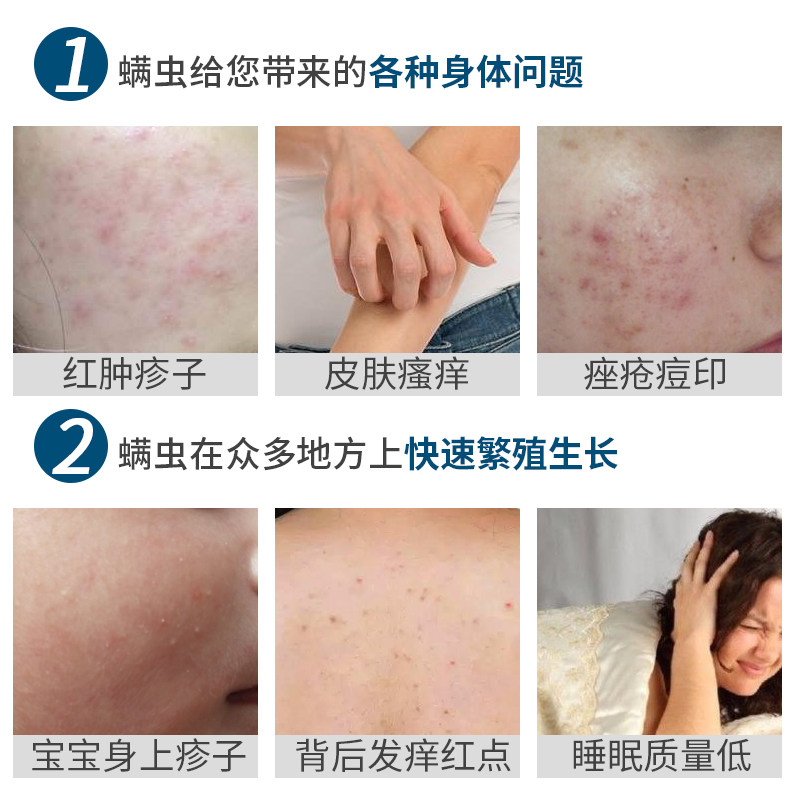 【1袋15包】天然去螨虫除螨虫包祛螨去螨床上用驱螨家用神器克星