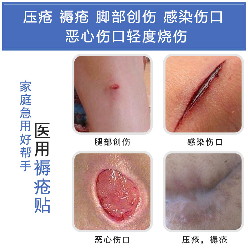 褥疮贴压疮贴尾部老人护理臀部减压医用泡沫伤口敷料