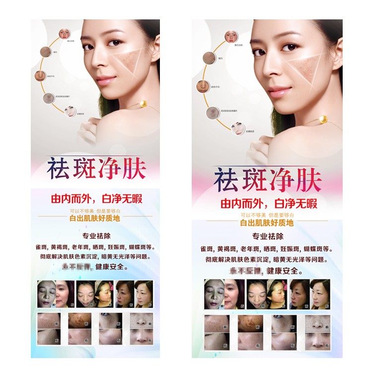 美容净肤美肤挂图皮秒祛斑养生皮肤管理海报x展架