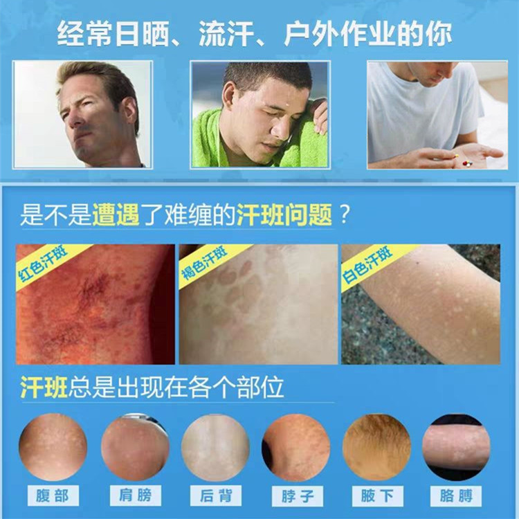 汗斑专用皮肤非药白祛褐白色灵香露去汗斑净斑点白点汉斑水喷剂ww