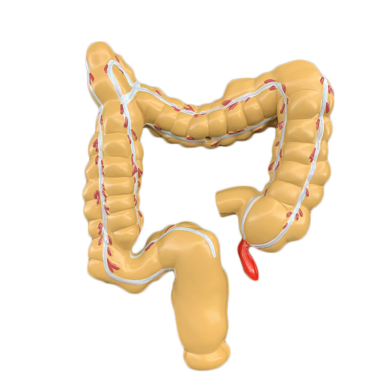 模型人体结肠病变肛肠消化内科大肠医学解剖其他模型玩具