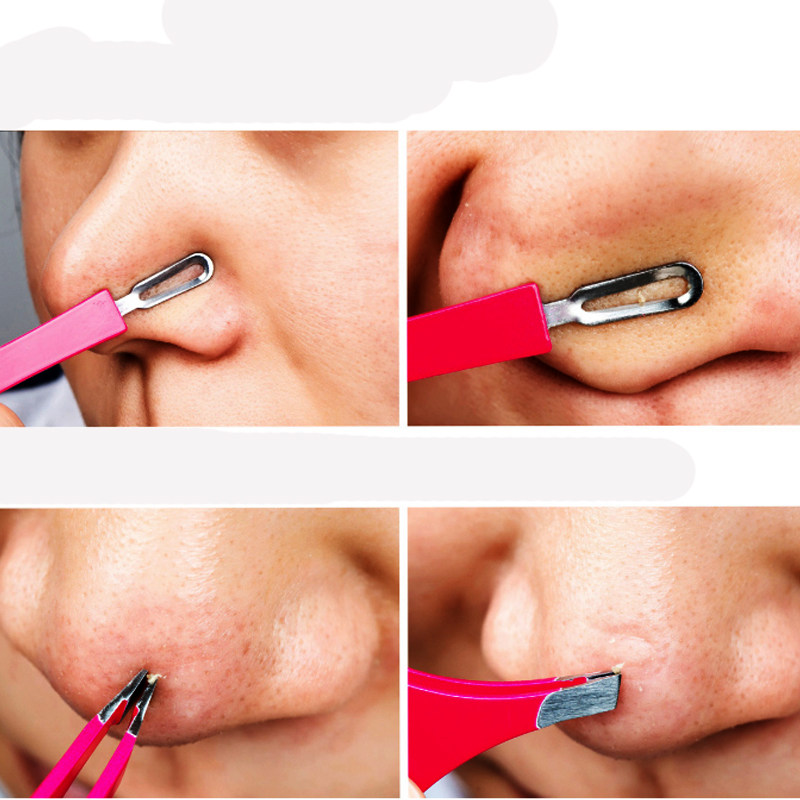 日本lucky trendy角栓去黑头白头粉刺夹子镊子粉刺针细胞夹 眉夹