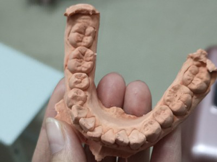定制取石膏牙模制作包材料包隐形牙套印石膏自助取模制作工具