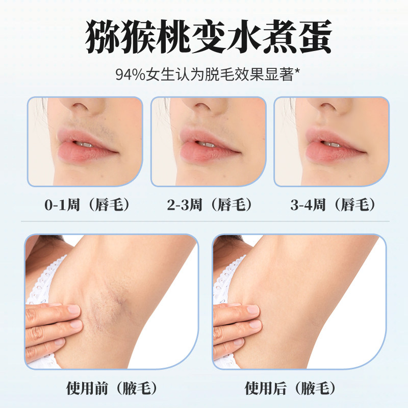 脱毛康堡仕冰点激光家用神器唇毛腋毛私处女士女士脱毛